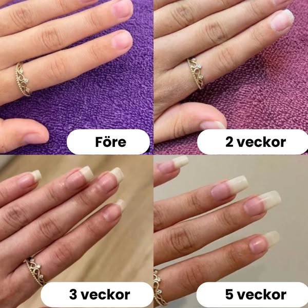 Nagelboost - Slipp dyra salongbesök